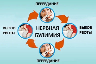 Лечение булимии в Хотьково